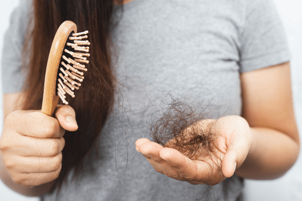 QUEDA DE CABELO Causas, Tratamentos e Dicas para Prevenir a Perda Capilar